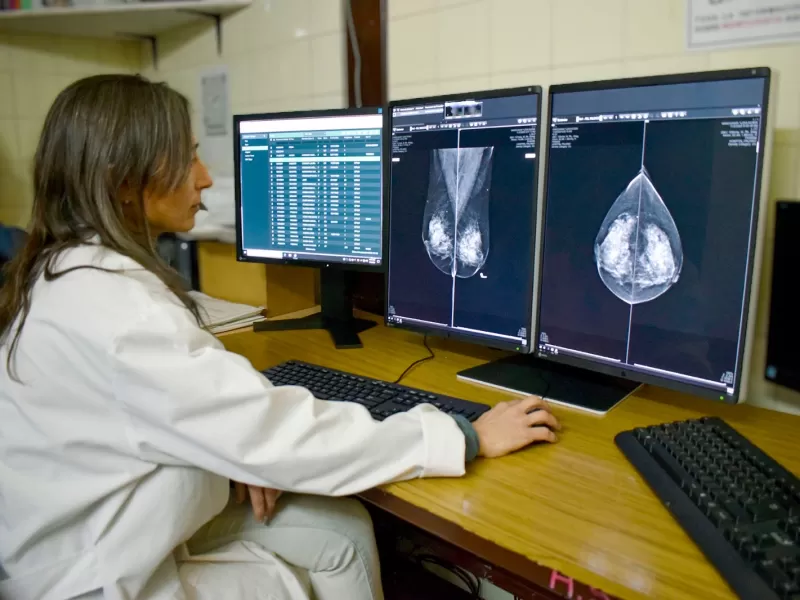 El hospital San Martín incorporó equipamiento para informar mamografías