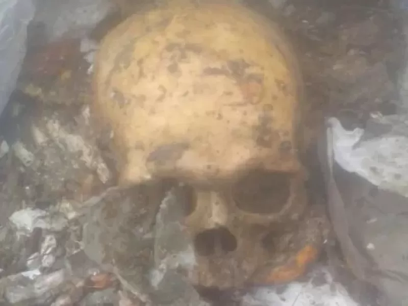Hallaron un cráneo en el Volcadero Municipal e investigan si es humano